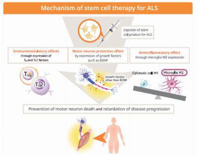 First licensed stem cell therapy for ALS